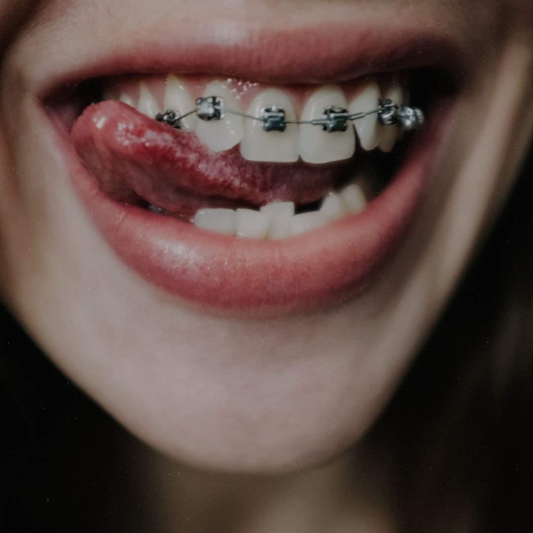 Diseño de Sonrisa